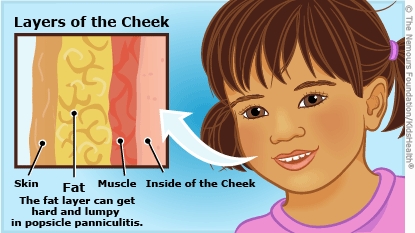 KidsHealth Image