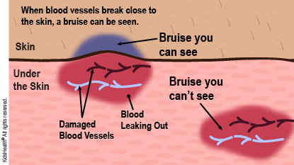 KidsHealth Image