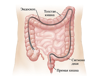 Схема живота, показывающая, как эндоскоп вводится через задний проход во всю толстую кишку.