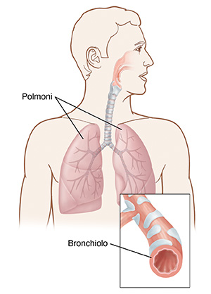 Illustrazione dei polmoni e vista ravvicinata di un bronchiolo.