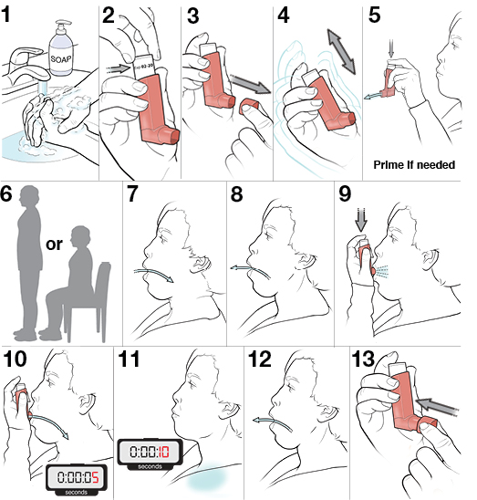 13 steps for using an MDI without a spacer