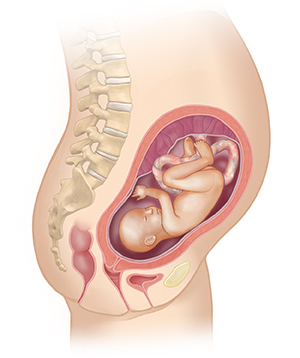 Vista lateral del cuerpo de una mujer donde se muestra el aparato reproductor y un feto de 5 meses.