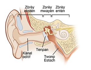 Imaj ki montre yon koup transvèsal zòrèy ekstèn nan, zòrèy mwayèn nan ak zòrèy entèn nan, ak tout kànal oditif la, tenpan an, ak twonp Estach la.