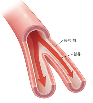 혈류가 보이는 동맥의 단면도.