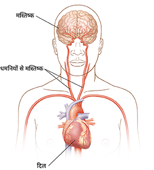 कैरोटिड धमनियों, दिल और मस्तिष्क को दर्शाने वाला सिर और ऊपरी शरीर के सामने का दृश्य।